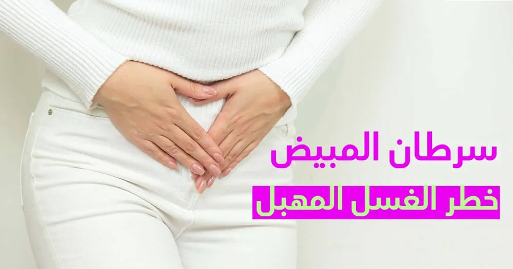 سرطان المبيض خطر الغسل المهبل